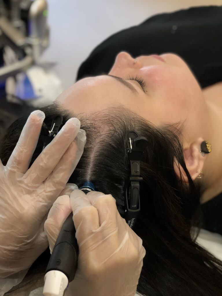 a model with black hair is taking hydrafacial for scalp